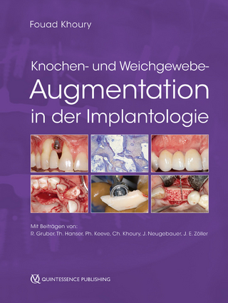 Knochen- und Weichgewebeaugmentation in der Implantologie - Fouad Khoury