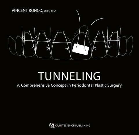 Tunneling - Vincent Ronco
