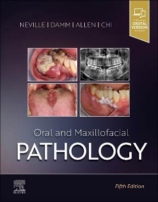 Oral and Maxillofacial Pathology - Brad W. Neville, Douglas D. Damm, Carl M. Allen, Angela C. Chi