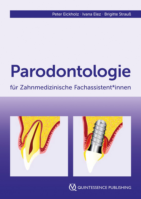 Parodontologie für Zahnmedizinische Fachassistent*innen - Peter Eickholz, Ivana Elez, Brigitte Strauß
