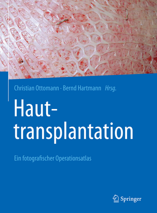 Hauttransplantation - Christian Ottomann; Bernd Hartmann
