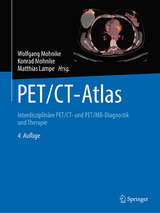PET/CT-Atlas - Mohnike, Wolfgang; Mohnike, Konrad; Lampe, Matthias
