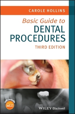 Basic Guide to Dental Procedures - Carole Hollins