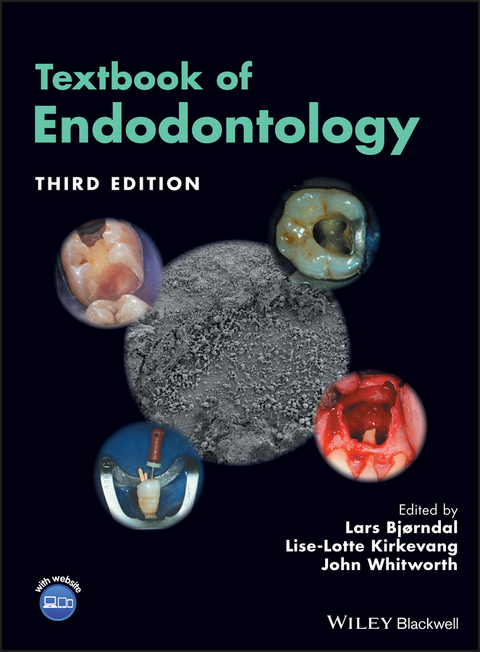 Textbook of Endodontology - 