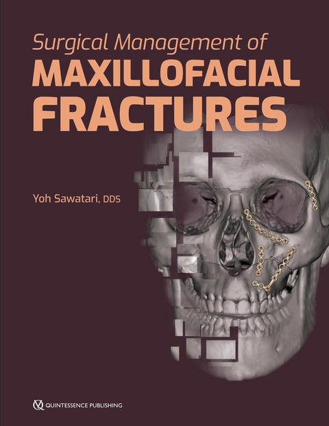 Surgical Management of Maxillofacial Fractures - Yoh Sawatari