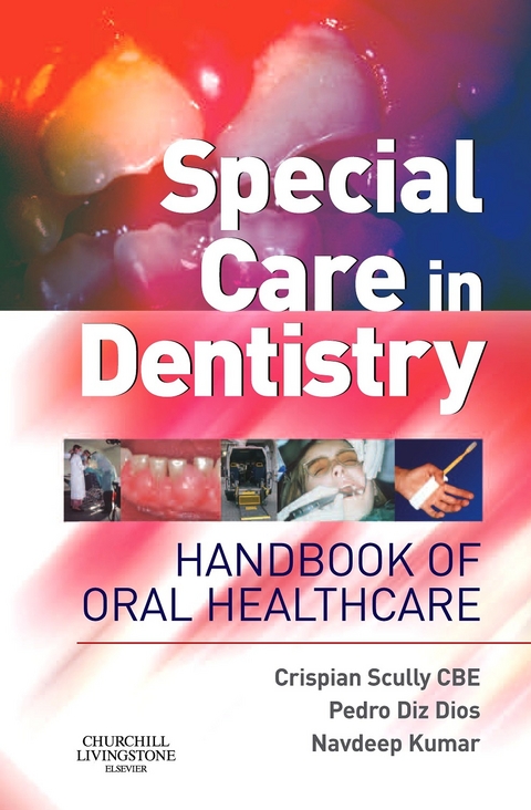 Special Care in Dentistry E-Book -  Pedro Diz Dios,  Navdeep Kumar,  Crispian Scully