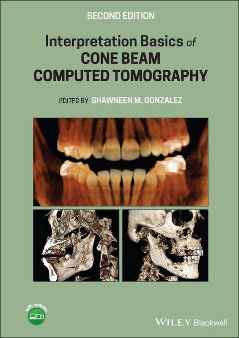 Interpretation Basics of Cone Beam Computed Tomography - 