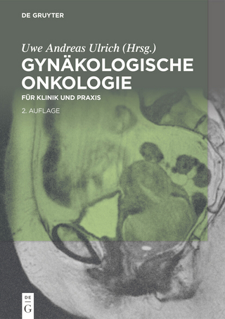 Gynäkologische Onkologie - Uwe Andreas Ulrich