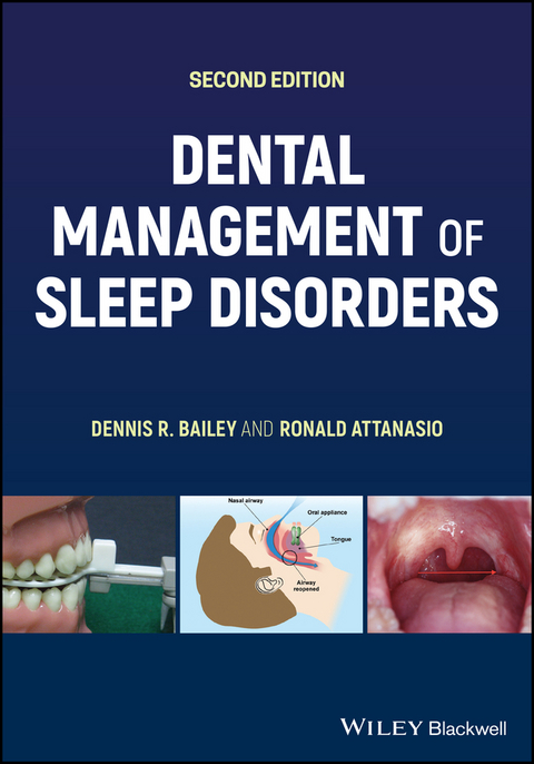 Dental Management of Sleep Disorders -  Ronald Attanasio,  Dennis R. Bailey