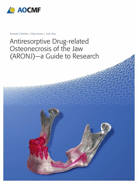 Antiresorptive Drug-Related Osteonecrosis of the Jaw (ARONJ) - A Guide to Research - 