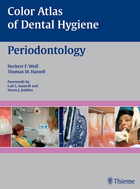Color Atlas of Dental Hygiene: Periodontology - 