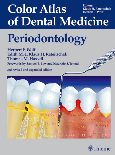 Color Atlas of Dental Medicine: Periodontology - 