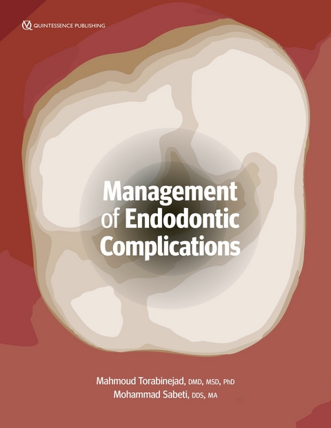 Management of Endodontic Complications - Mahmoud Torabinejad, Mohammad Sabeti