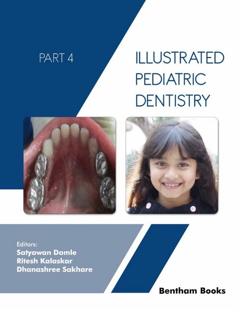 Illustrated Pediatric Dentistry - Part 4 - 