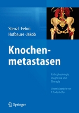 Knochenmetastasen -  Arnulf Stenzl,  Tanja Fehm,  Lorenz C. Hofbauer,  Franz Jakob