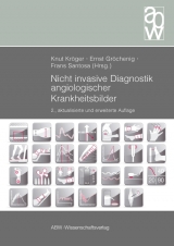 Nicht invasive Diagnostik angiologischer Krankheitsbilder - Kröger, Knut; Gröchenig, Ernst; Santosa, Frans
