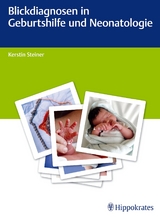 Blickdiagnosen in Geburtshilfe und Neonatologie - 