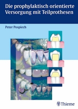 Die prophylaktisch orientierte Versorgung mit Teilprothesen - Peter Pospiech