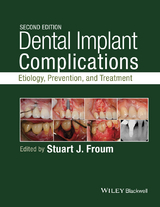 Dental Implant Complications - 