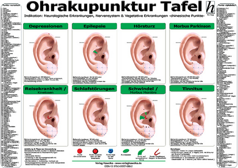 Ohrakupunktur Tafel - Indikation: Neurologische Erkrankungen, Nervensystem & Vegetative Erkrankungen - 