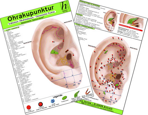 Ohrakupunktur - Indikation: Vasomotorischer Kopfschmerz - chinesische Ohrakupunktur / Medizinische Taschen-Karte - 