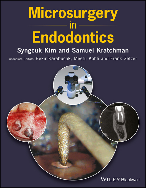 Microsurgery in Endodontics - 
