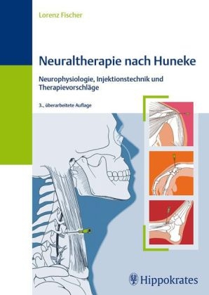 Neuraltherapie nach Huneke - Lorenz Fischer