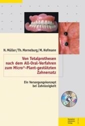 Von Totalprothesen nach dem All-Oral-Verfahren zum Micro©-Plant-gestützten Zahnersatz - Norbert Müller, Thomas Morneburg, Manfred Hofmann