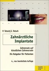 Zahnärztliche Implantate - Peter Tetsch, Jan Tetsch