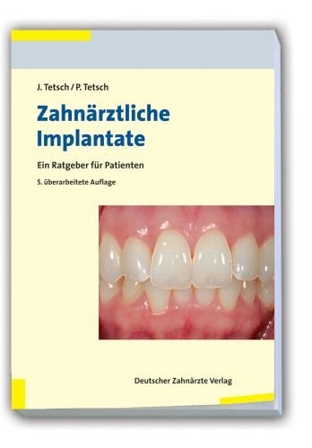 Zahnärztliche Implantate - Jan Tetsch, Peter Tetsch