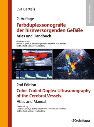 Farbduplexsonografie der hirnversorgenden Gefäße / Color-Coded Duplex Ultrasonography of the Cerebral Vessels - Eva Bartels