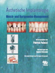 Ästhetische Implantologie - 