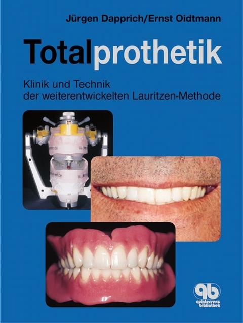 Totalprothetik - Jürgen Dapprich, Ernst Oidtmann