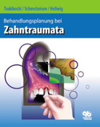 Behandlungsplanung bei Zahntraumata - Mitsuhiro Tsukiboshi, Rainer Schmelzeisen, Elmar Hellwig