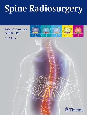 Spine Radiosurgery - 