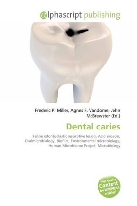 Dental Caries - Frederic P Miller, Agnes F Vandome, John McBrewster