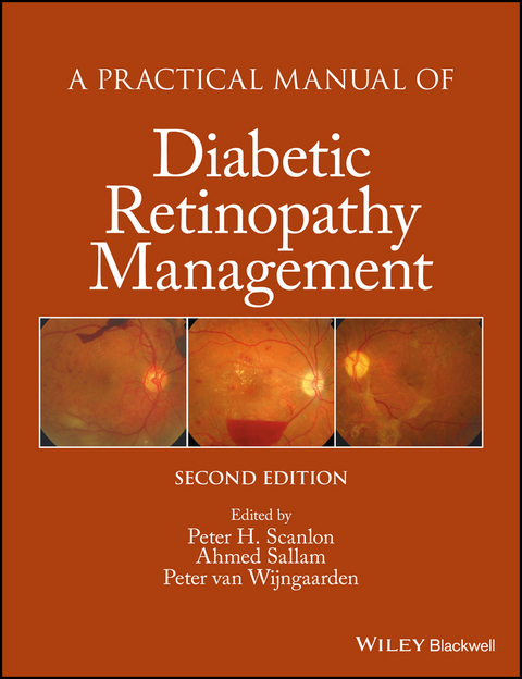 Practical Manual of Diabetic Retinopathy Management - 