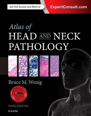 Atlas of Head and Neck Pathology - Bruce M. Wenig