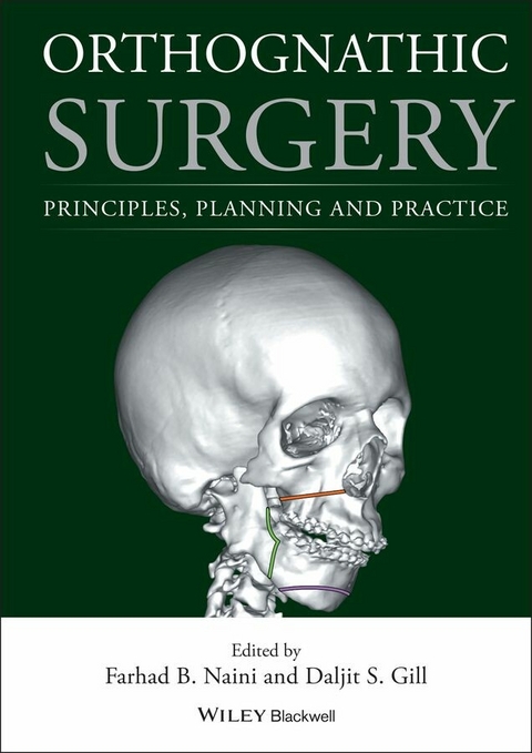 Orthognathic Surgery - 