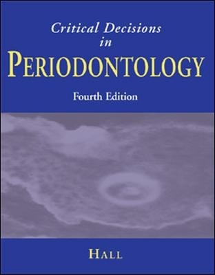 Critical Decisions in Periodontology - Walter Hall
