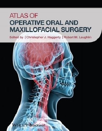 Atlas of Operative Oral and Maxillofacial Surgery - 