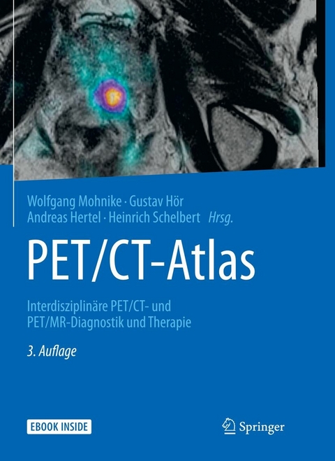 PET/CT-Atlas - 