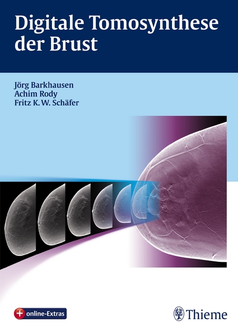 Digitale Tomosynthese der Brust - Jörg Barkhausen, Achim Rody, Fritz K.W. Schäfer