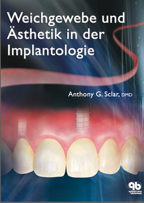 Weichegewebe und Ästhetik in der Implantologie - Anthony G. Sclar