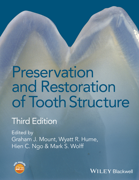 Preservation and Restoration of Tooth Structure - 
