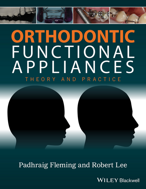 Orthodontic Functional Appliances - 