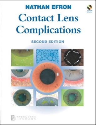 Contact Lens Complications - Nathan Efron