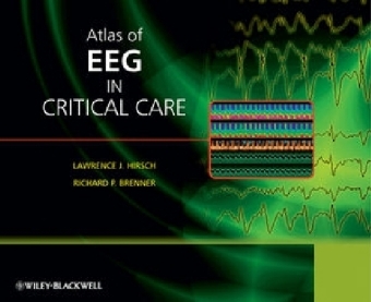 Atlas of EEG in Critical Care - LJ Hirsch