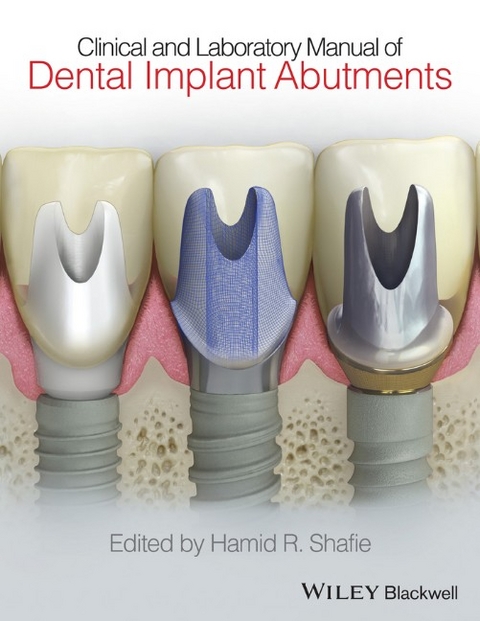Clinical and Laboratory Manual of Dental Implant Abutments - Hamid R. Shafie