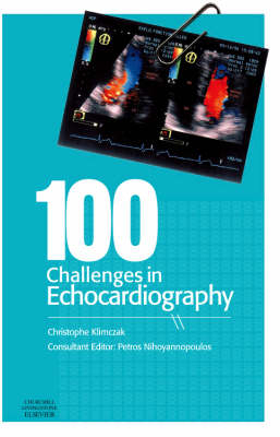 100 Challenges in Echocardiography - Christophe Klimczak, Petros Nihoyannopoulos